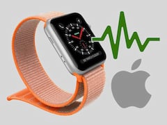 Wird die Apple Watch auch in Deutschland zum EKG-Monitor?