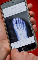 Digitale Gesundheitsakte in Form einer App